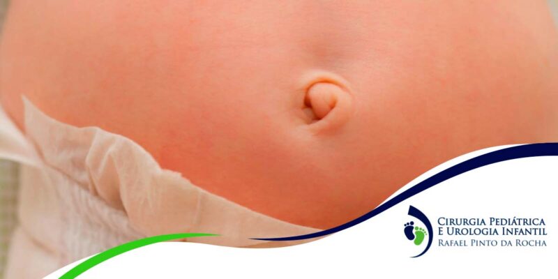 Hérnia inguinal e umbilical infantil: o que são, quais as diferenças e ...